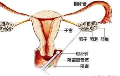 武汉试管婴儿医院有哪些？武汉试管婴儿医院哪里成功率高？