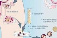 郑州哪家医院做高龄试管婴儿的技术更好？选择三代试管有哪些优势？