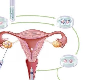 衡阳试管婴儿哪个医院较好？