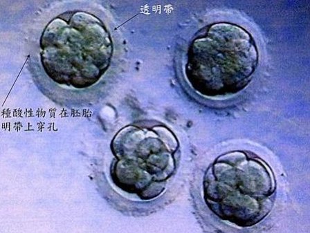 黑龙江省佳木斯市试管现状如何？黑龙江省佳木斯市试管怀孕医院推荐！